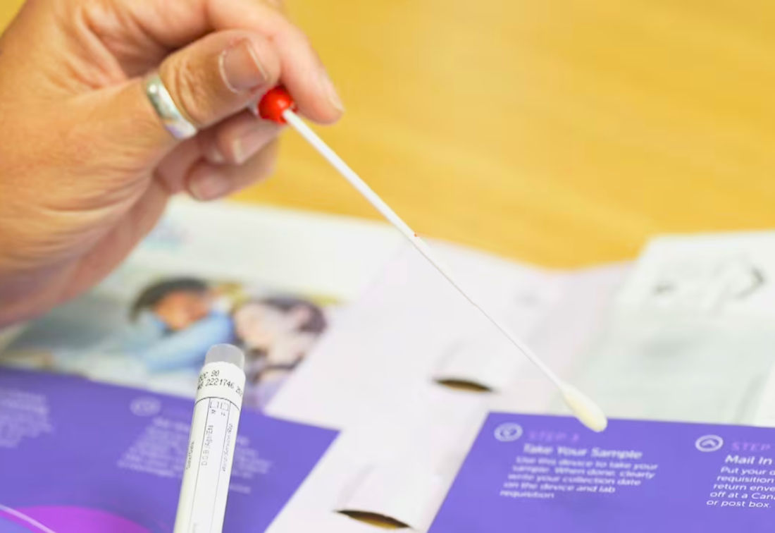 Healthcaretoday, ROSE project, HPV test, cervical Screening, Self-sampling HPV test, Professor Dr Woo Yin Ling, Cervical cancer, 
