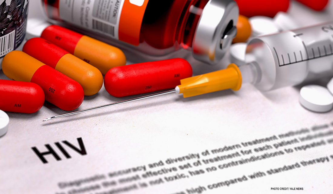 Healthcaretoday, HIV, HIV treatment, anti-retroviral treatment, brain volume in HIV patients