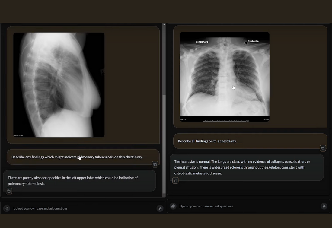 Healthcaretoday, Harrison AI, Healthtech company, radiology, Mass General Brigham, American College of Radiology, radiographs, Healthcare AI Challenge, AI, Dr Aengus Tran, DICOM images, radiology reports, chest X-rays, 