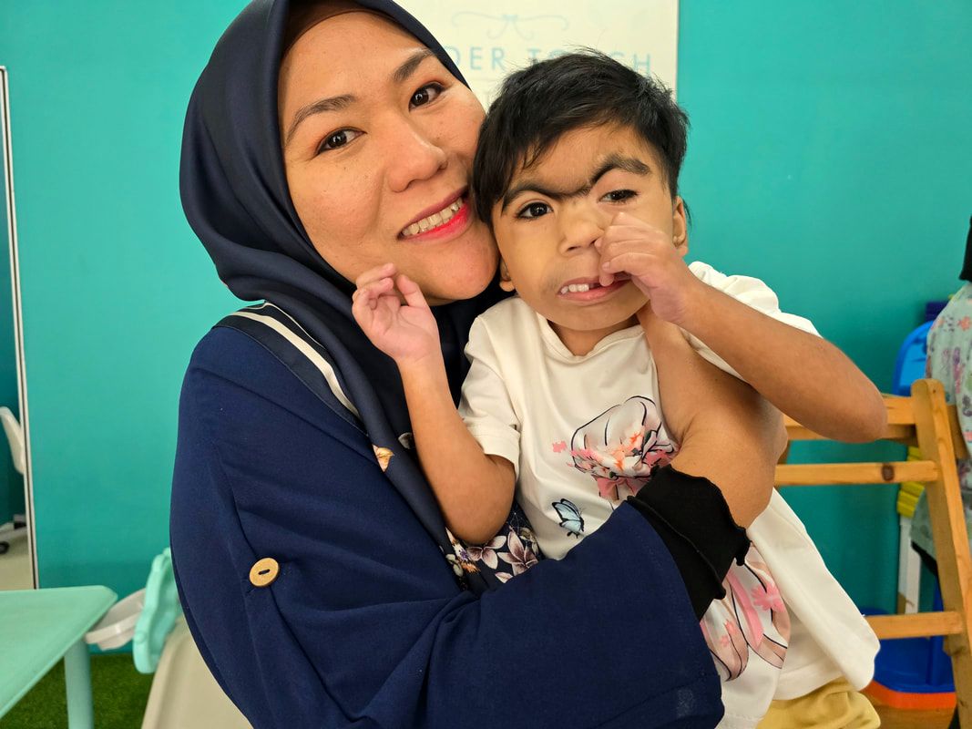 Healthcaretoday, Tender Touch Pediatric Rehab, Cornelia De Lange Syndrome, Rare diseases, CDLS, Special needs, Genetic disorder, Special needs parenting, Rare disease awareness, Pediatric health, Genetic Syndrome, Disability awareness, Special needs children,