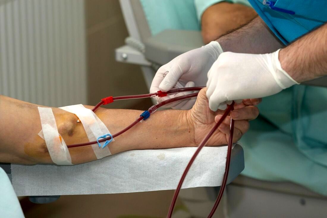 Healthcaretoday, National Kidney Foundation, Kidney care Malaysia, Kidney disease, Renal health, Chronic kidney disease, Kidney transplant, diabetes, Hypertension, Dialysis patients, Kidney failure, renal disease, 