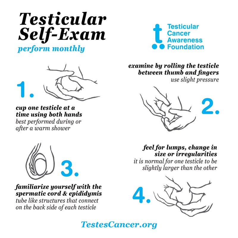 Healthcaretoday, Dr Goh Eng Hong, Urologist, Prince Court Medical Centre, Testicular health,  Scrotal masses, Men's health, Testicular lumps, Epididymitis, Hydrocele, Testicular cancer, Men's health matters, Testicle self examination, Infertility,  