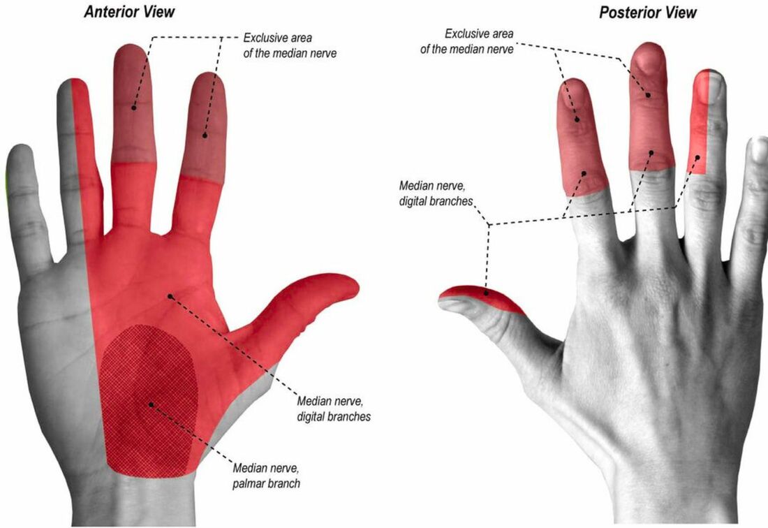 Healthcaretoday, Carpal tunnel syndrome, sensory loss, Dr Mohamed Faizal Sikkandar, Orthopedic Surgeon, Computer use, prickling sensation, index finger, middle finger, Tinels test, wax therapy, 
