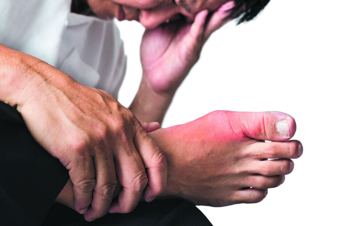 Healthcaretoday, Dr Kheng Kien Soo, Clinic Kheng, Sabah, Gout, hyperuricemia, uric acid, inflammation, urate crystals, gout awareness, gout pain, gout triggers, high uric acid, gout relief, gout diet, joint health, gout and you, 