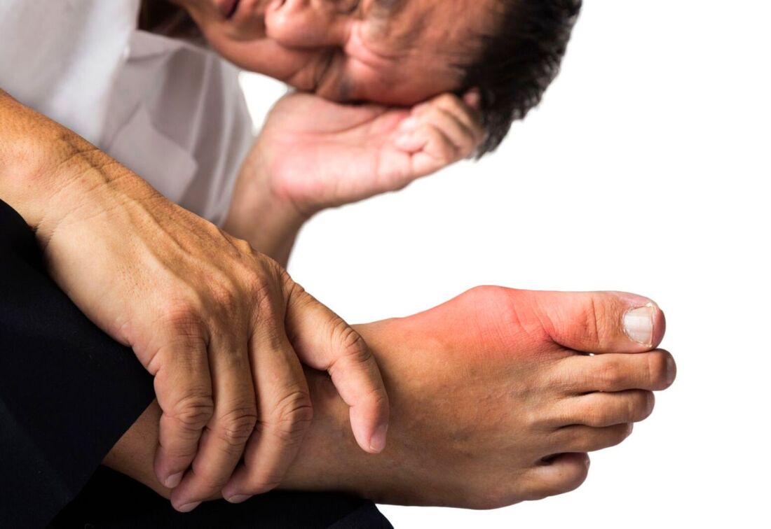 Healthcaretoday, Inflammatory arthritis, Rheumatology, Joint pain, Autoimmune disease, Rheumatoid arthritis, Lupus, Spondyloarthritis, Psoriatic Arthritis, Gout, Osteoarthritis, Musculoskeletal pain, Medical education, Dr Lydia Pok Say Lee, Sunway Medical Centre Sunway City, 