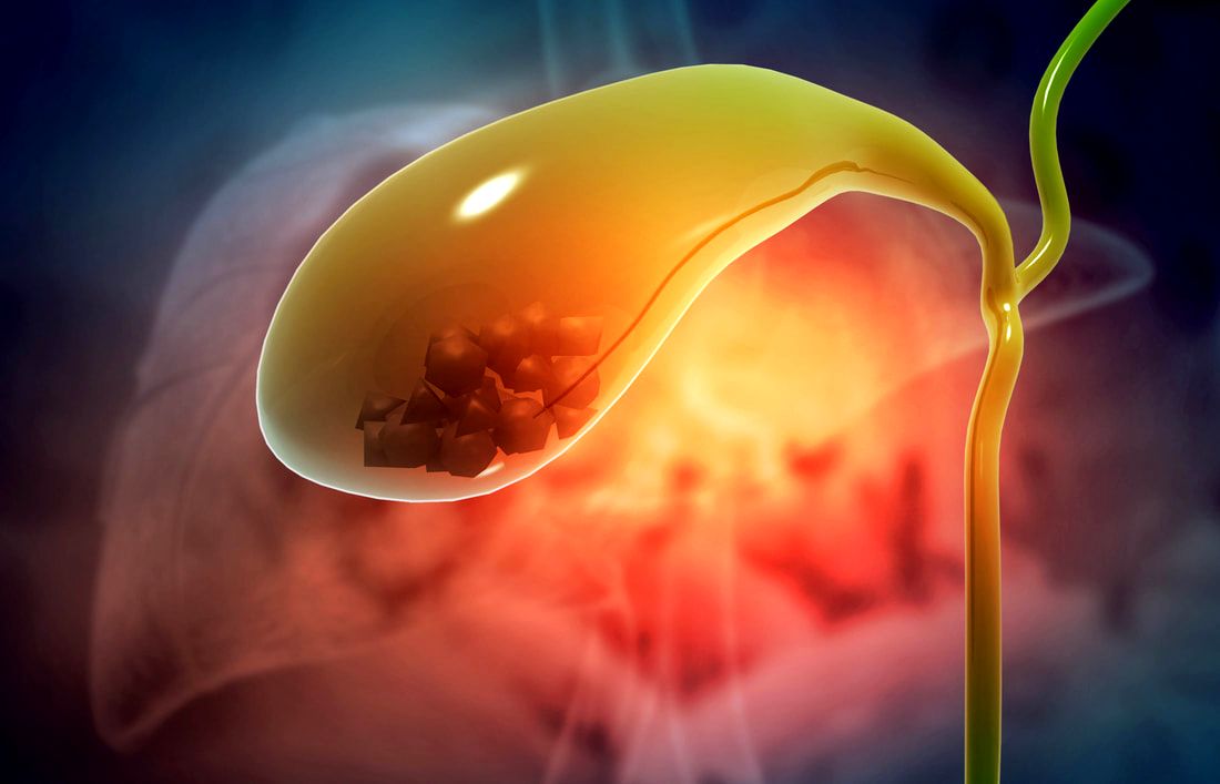 Healthcaretoday, Assunta Hospital, Diabetes, gallstones, jaundice, gallbladder disease, abdominal pain, cholangitis, sepsis, acute pancreatitis, epigastric pain, abdominal pain, pancreatic cancer, back pain, Dr Kamarajan Ramayah, 