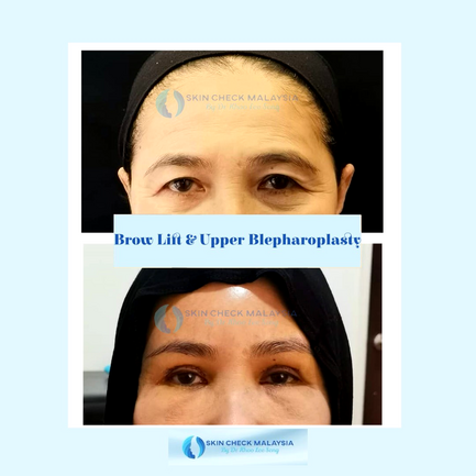 Healthcaretoday, Dr Khoo Lee Seng, Skin Check Malaysia, facial feng shui, neck-lift, frown lines, feng shui, facial reading, rhinoplasty, chin augmentation, midface lift, eyebag, mole transplant, jaw surgery, 