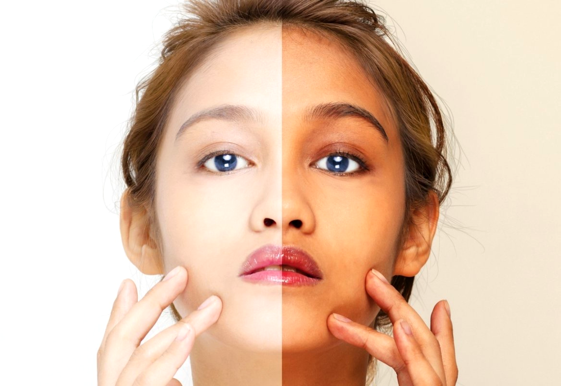 Healthcaretoday, lighter complexion, fair skin, skin lighteners, glutathione, kulit putih, kulit cerah, Vitamin C drip, 